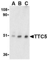 NBP1-76636 - TTC5