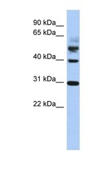 NBP1-54787 - TTL