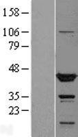 NBL1-17416 - TTL Lysate
