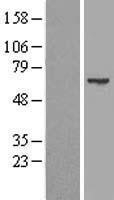 NBL1-17420 - TTLL6 Lysate