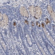 NBP1-85992 - TTYH1