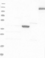 NBP1-85992 - TTYH1