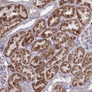 NBP1-92547 - TUBGCP3