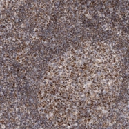 NBP1-84889 - TUFM