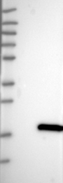 NBP1-86794 - TUSC2