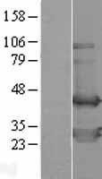 NBL1-17459 - TWF2 Lysate