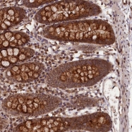 NBP1-87676 - KIAA0174 / IST1