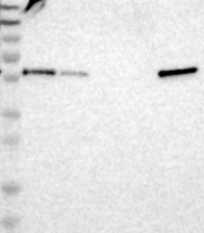 NBP1-92550 - TXNDC10 / TMX3