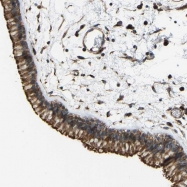 NBP1-85616 - TXNDC3 / SPTRX2