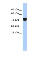 NBP1-56623 - TXNDC4 / ERP44
