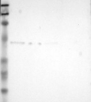 NBP1-89617 - TXNDC4 / ERP44