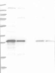 NBP1-89051 - TXNDC9 / APACD