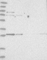 NBP1-89052 - TXNDC9 / APACD
