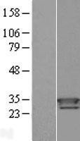 NBL1-17473 - TXNDC9 Lysate