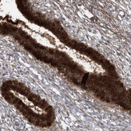NBP1-84784 - TXNIP / VDUP1
