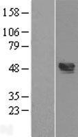 NBL1-17474 - TXNIP Lysate