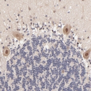 NBP1-86900 - TXNL1