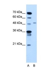 NBP1-69356 - TYRP1