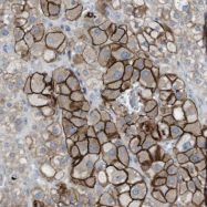 NBP1-83814 - TYW1 / RSAFD1