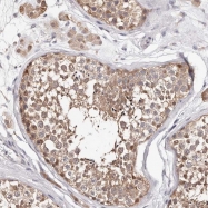 NBP1-88492 - TYW3