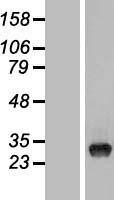 NBL1-17487 - TYW3 Lysate