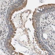 NBP1-92476 - TTBK2