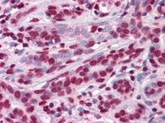 NBP1-42564 - ZBTB7B