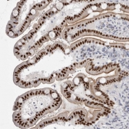 NBP1-88078 - ZBTB7B