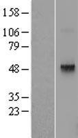 NBL1-17269 - Thyrotropin-Releasing Hormone Receptor Lysate