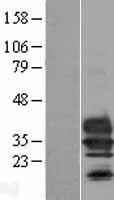 NBL1-17069 - Tmem27 Lysate