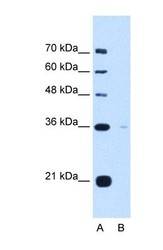 NBP1-69580 - Torsin-1B (TOR1B)