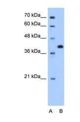 NBP1-60002 - Torsin-2A (TOR2A)
