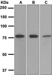 NBP1-95705 - Transferrin