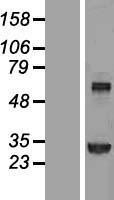 NBL1-16867 - Transglutaminase 2 Lysate