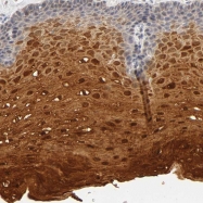 NBP1-86950 - Transglutaminase-3 (TGM3)