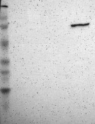 NBP1-86950 - Transglutaminase-3 (TGM3)