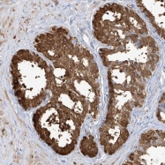 NBP1-86947 - Transglutaminase-4 (TGM4)