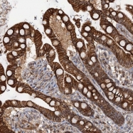 NBP1-86945 - Transglutaminase-5 (TGM5)