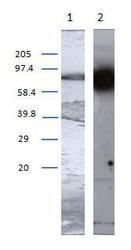NB100-1844 - Transglutaminase-1 (TGM1)