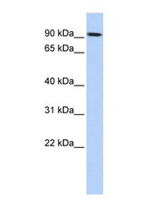 NBP1-56535 - Transglutaminase-1 (TGM1)