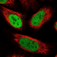 NBP1-87441 - Transketolase (TKT)