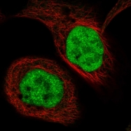 NBP1-87442 - Transketolase (TKT)