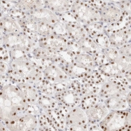 NBP1-87441 - Transketolase (TKT)