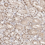 NBP1-87442 - Transketolase (TKT)