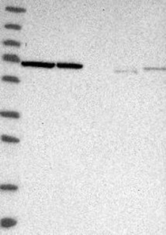 NBP1-87441 - Transketolase (TKT)