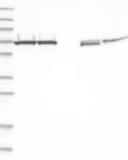 NBP1-87442 - Transketolase (TKT)