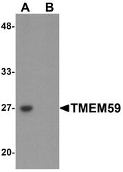 NBP1-76497 - TMEM59