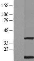 NBL1-17093 - Transmembrane protein 59 Lysate