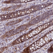NBP1-86908 - Treacle protein / TCOF1