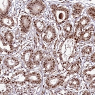 NBP1-86909 - Treacle protein / TCOF1
